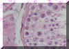 Túbulos Seminíferos y células de Leidyg intersticiales (H.E.60x)