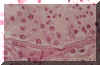 Túbulos Seminíferos y células de Leidyg (H.E.60x)